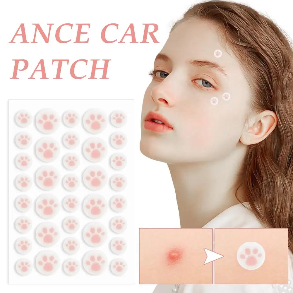 36 Cat Claw Invisible Acne Masks