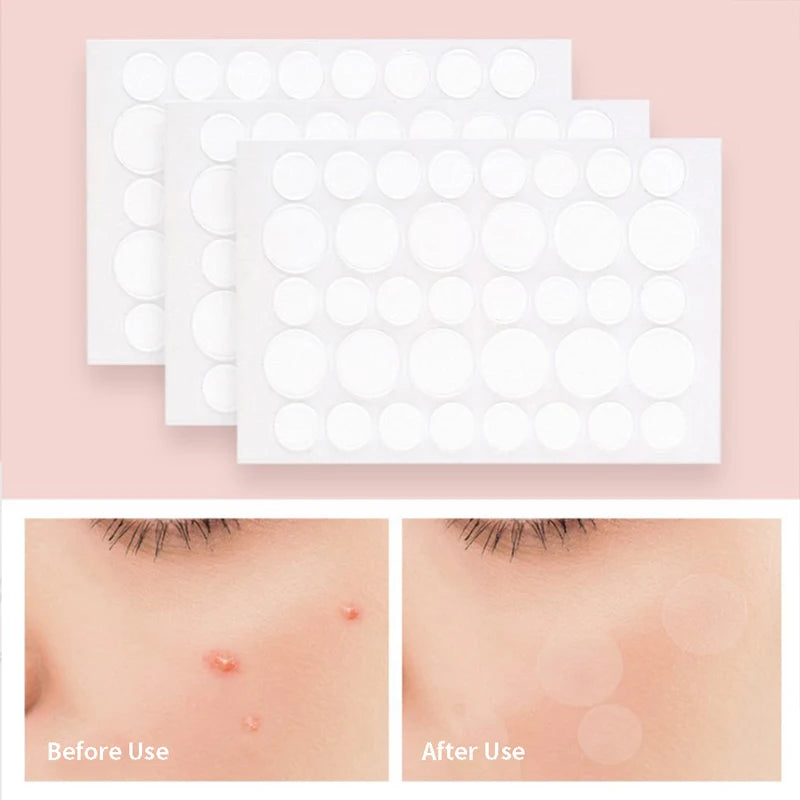 36 Waterproof Acne Pimple Patches