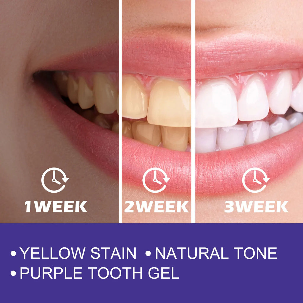 Purple Whitening Toothpaste Effectively Removing Dental Plaques and Yellow Stains Inhibit Bacteria Growth Oral Care Toothpaste