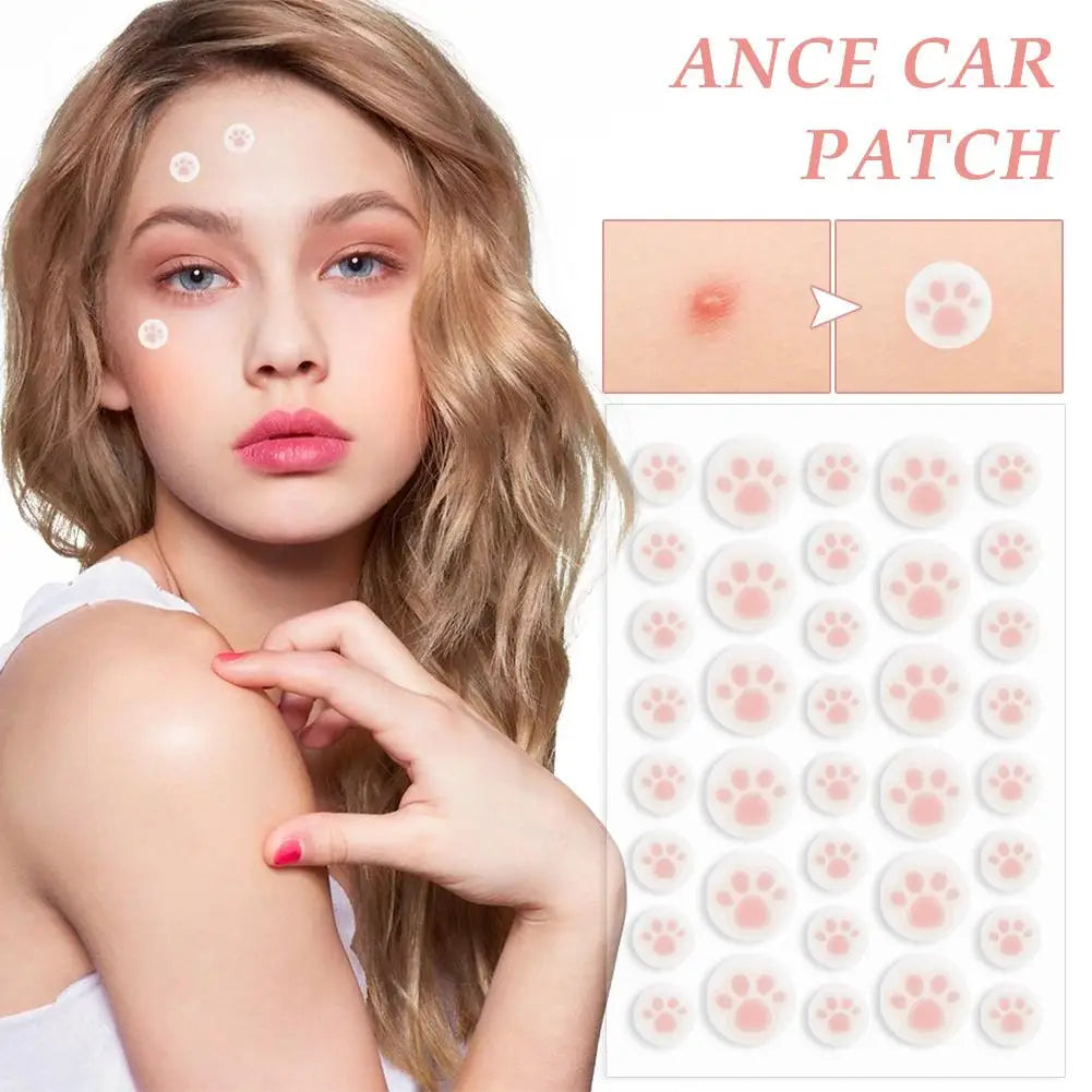 36 Cat Claw Invisible Acne Masks