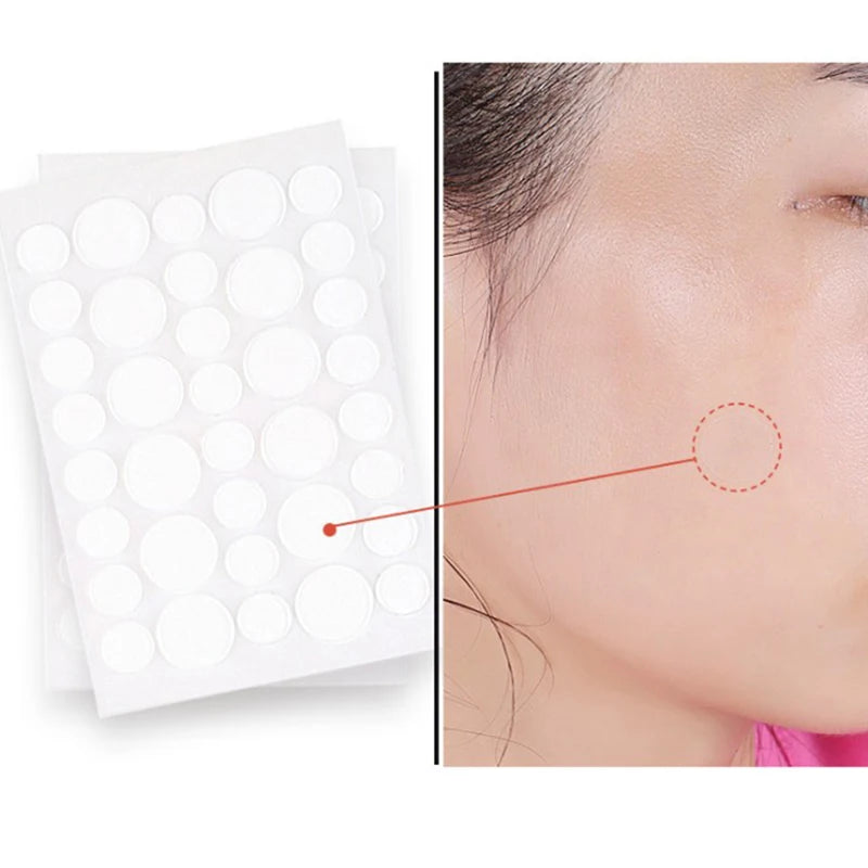 36 Waterproof Acne Pimple Patches