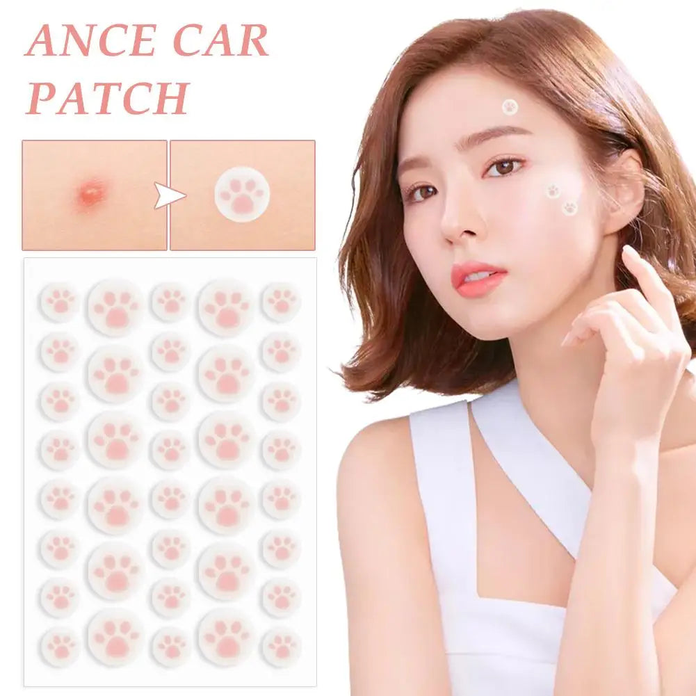 36 Cat Claw Invisible Acne Masks