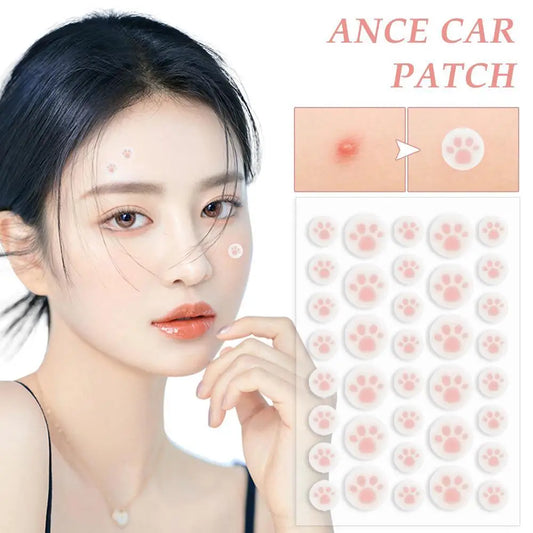 36 Cat Claw Invisible Acne Masks